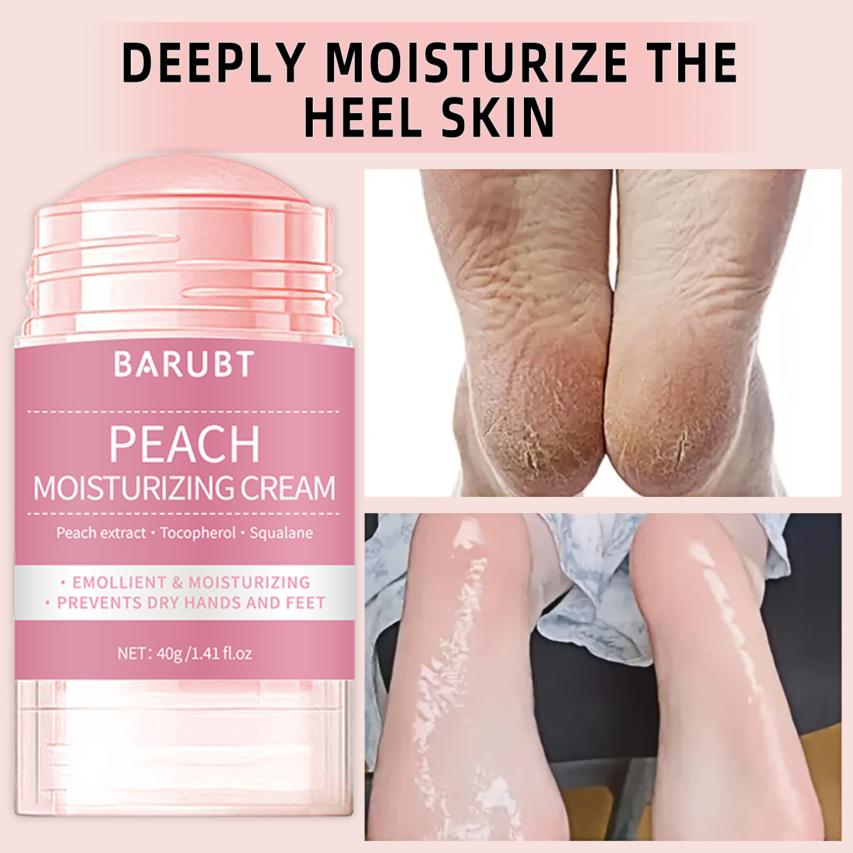 Peach urea mud film rod, salic - Azelaic Acid Cream incelemesi ve fiyatı
