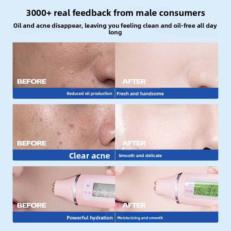 RUYI Men Skin Care Set Salicyl - Skincare Oil Control incelemesi ve fiyatı