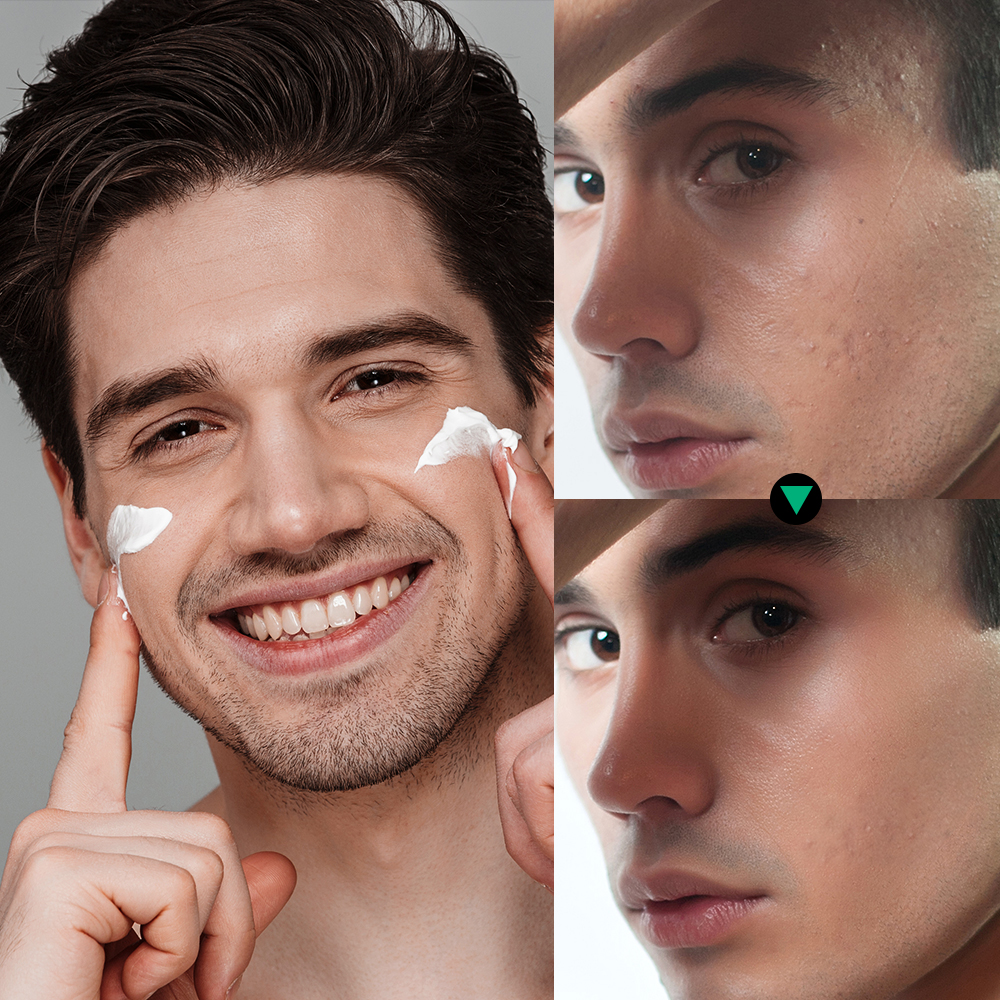 Lakerain Skin Care for Men Kit - Skincare Oil Control incelemesi ve fiyatı