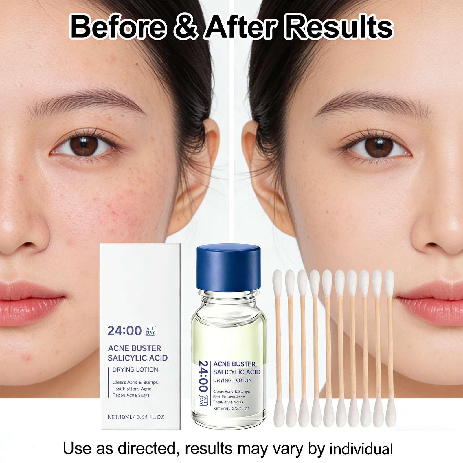 Salicylic Acid Drying Lotion F - Azelaic Acid Cream incelemesi ve fiyatı